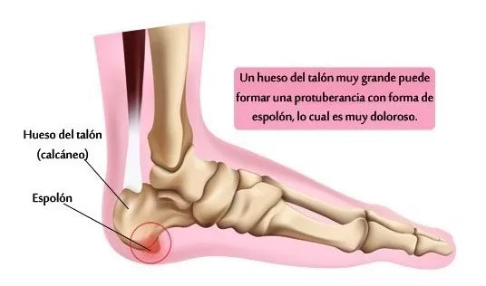 Plantillas de Gel Ortopédicas ™